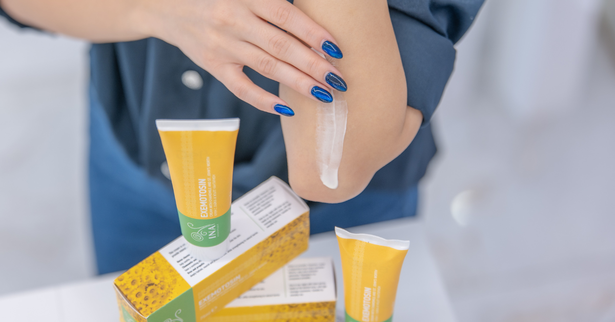 Как бързо да облекчим екземата: Ползвайте този натурален крем с лайка и жълт кантарион