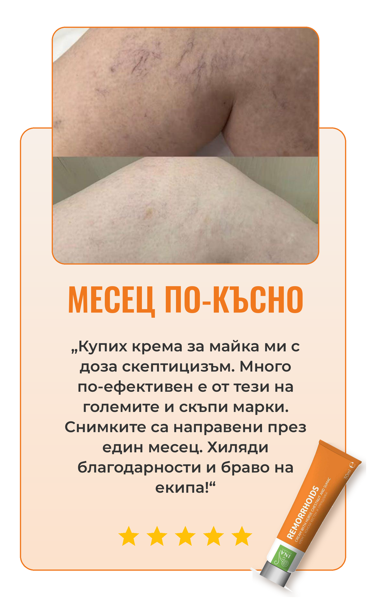 Ревю крем за вени 1