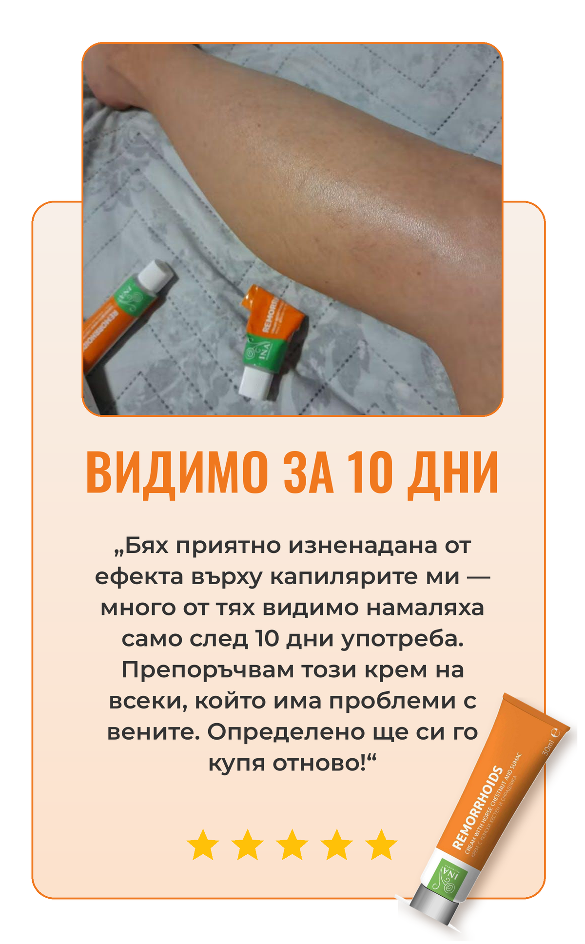 Ревю крем за вени 2
