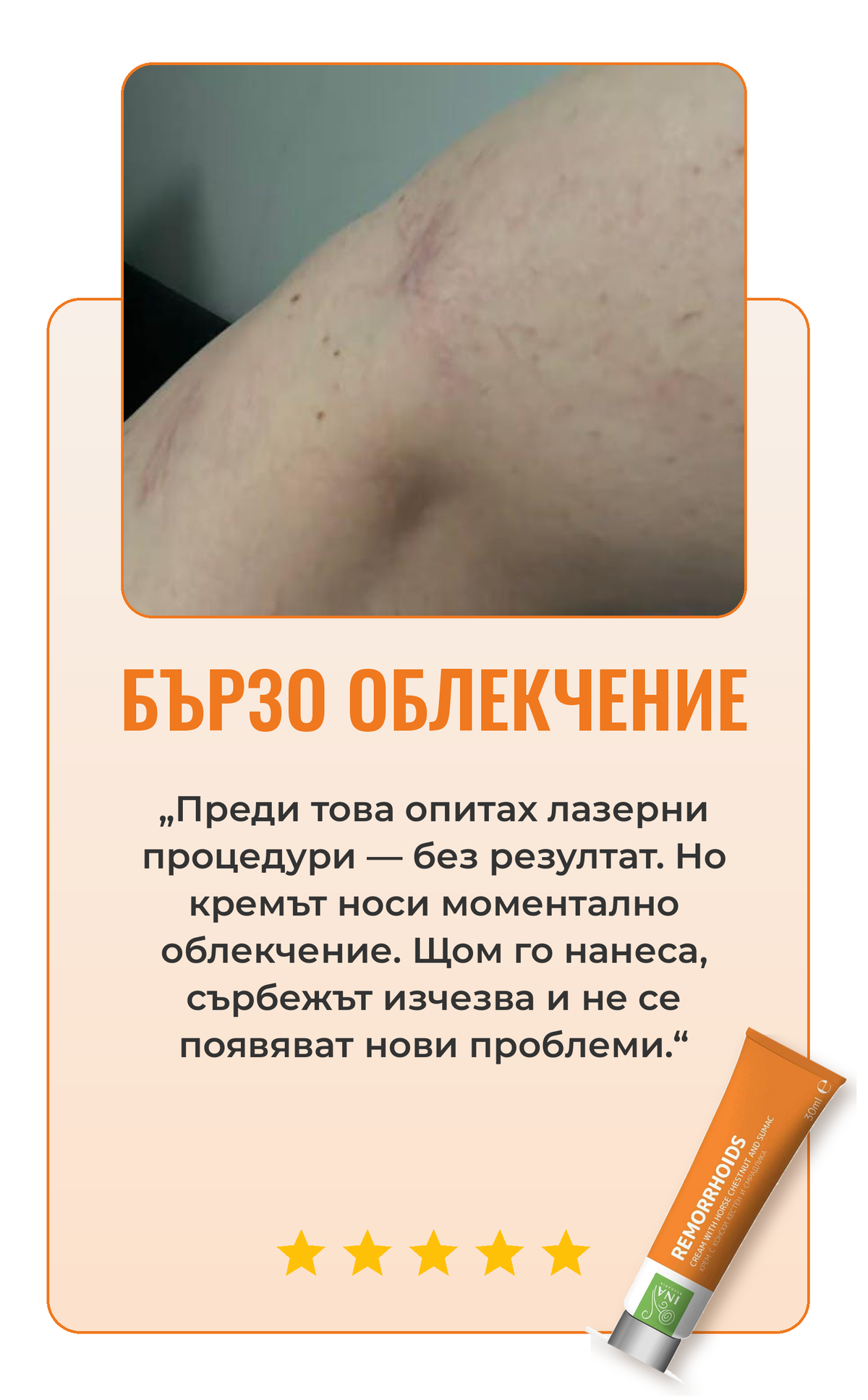 Ревю крем за вени 3