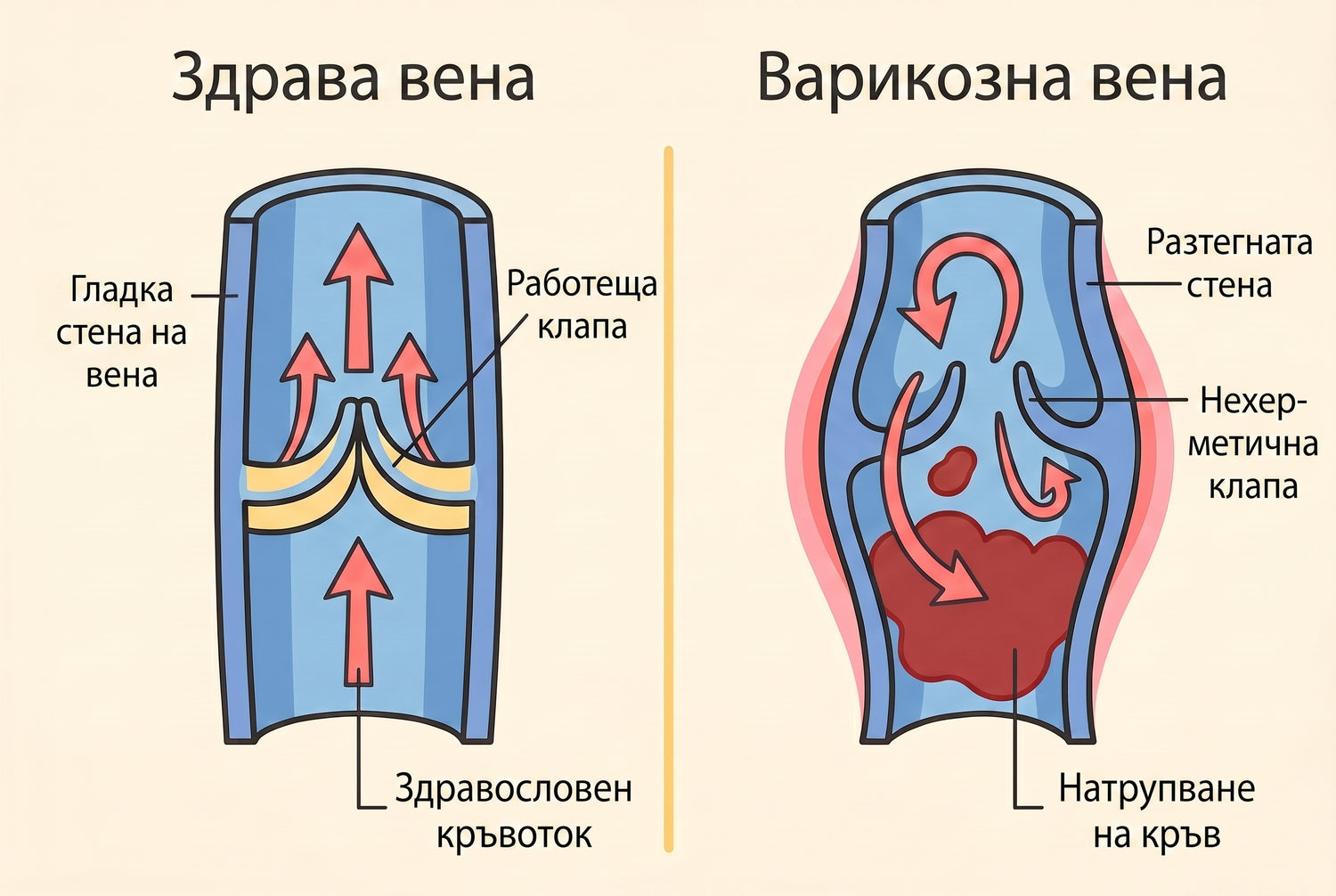BG infographic