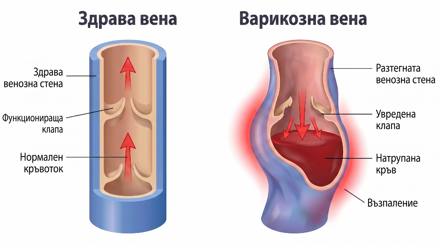 BG infographic