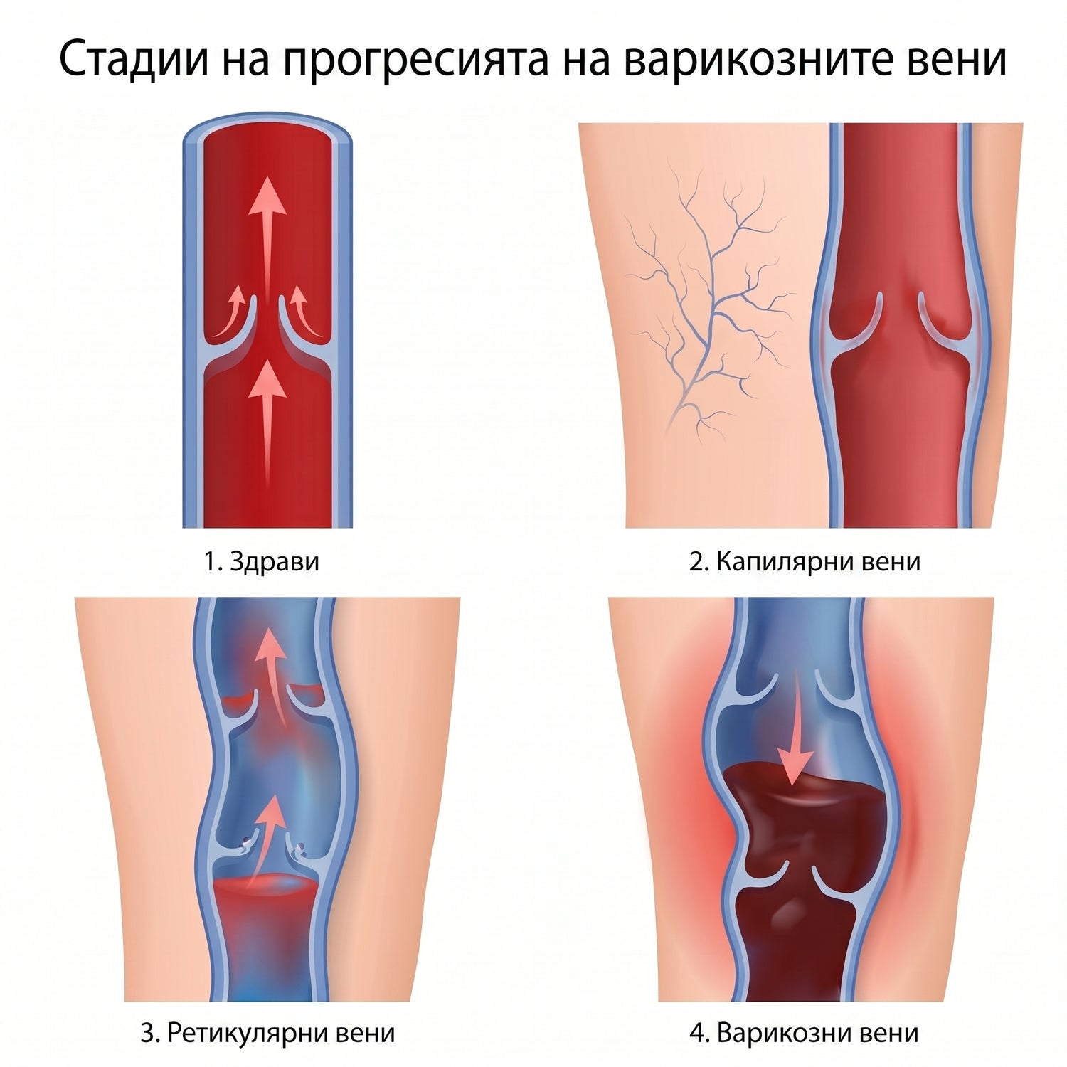 BG infographic